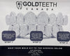 Canadian Diamond Boyz Dental Impression Mold Kit